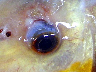 pseudomonas