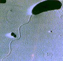 Vibrio Anguillarum